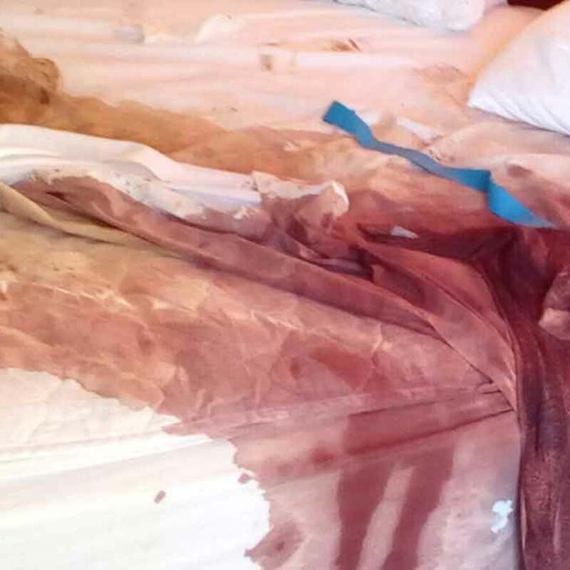 Limpieza fallecimiento traumático